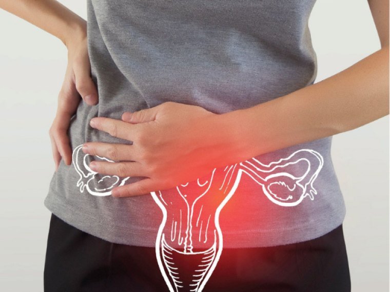 PCOS / PCOD Diet Program