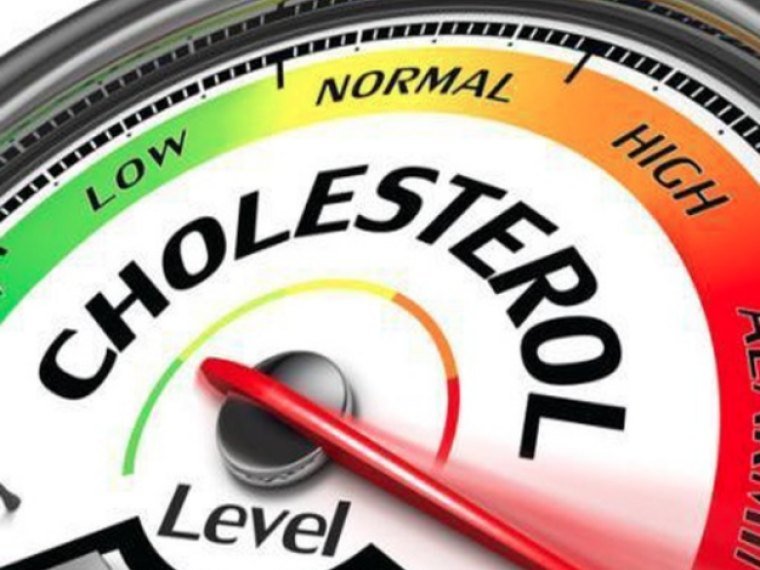 Cholesterol Management Program