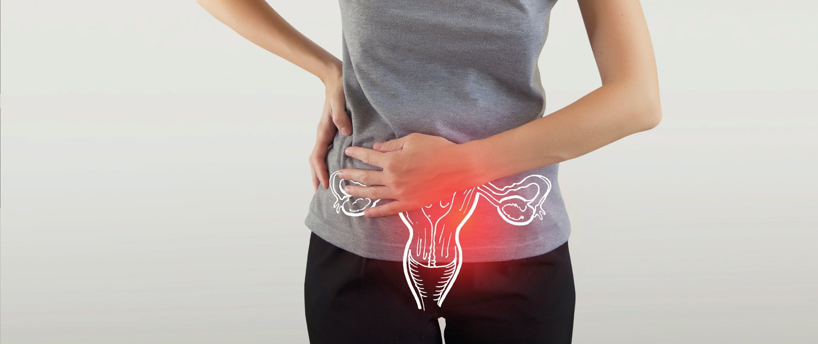 PCOS vs. PCOD: Key Differences and Symptoms